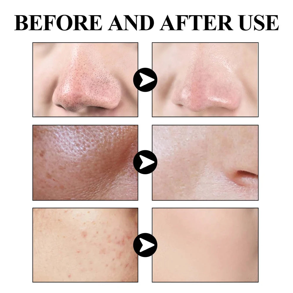 West & Month Blackhead Mud Film Face Mask Cleanser