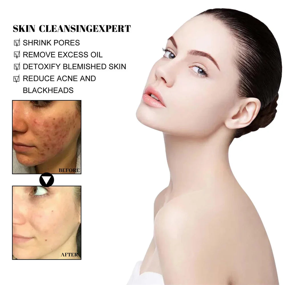 West & Month Blackhead Mud Film Face Mask Cleanser