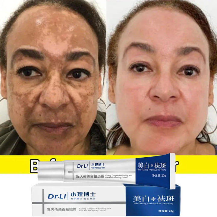 NNEOBA Whitening Freckles Cream - Korean Skincare
